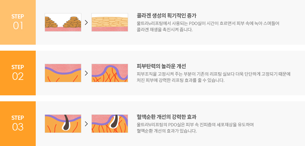 STEP1. 콜라겐 생성의 기획적인 증가 STEP2.피부탄력의 놀라운 개선 STEP.3 혈액순환 개선의 강력한 효과